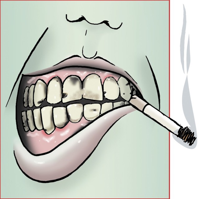 smoking-prompts-tooth-decay-oral-cancer-article-the-united-states-army