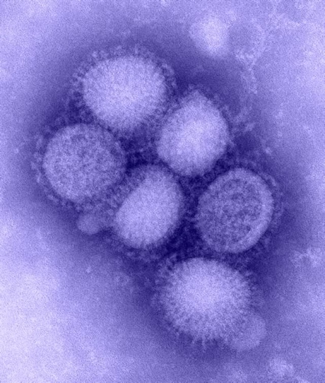 H1N1 Status Report