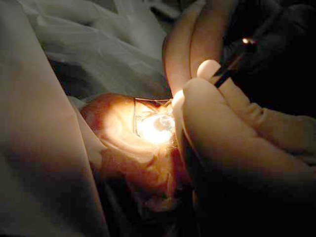 Cholutecea