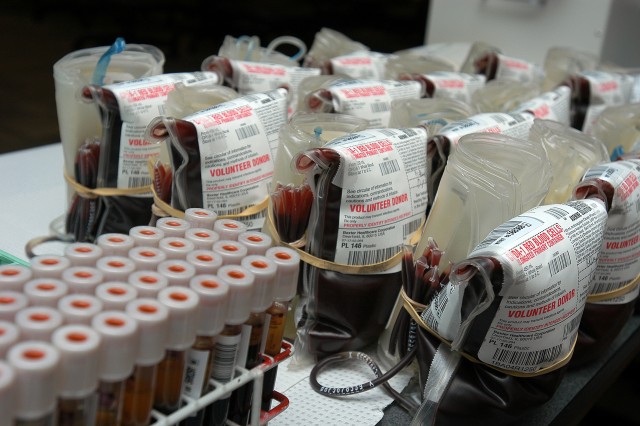 Dried plasma may be approved for Army use within five years