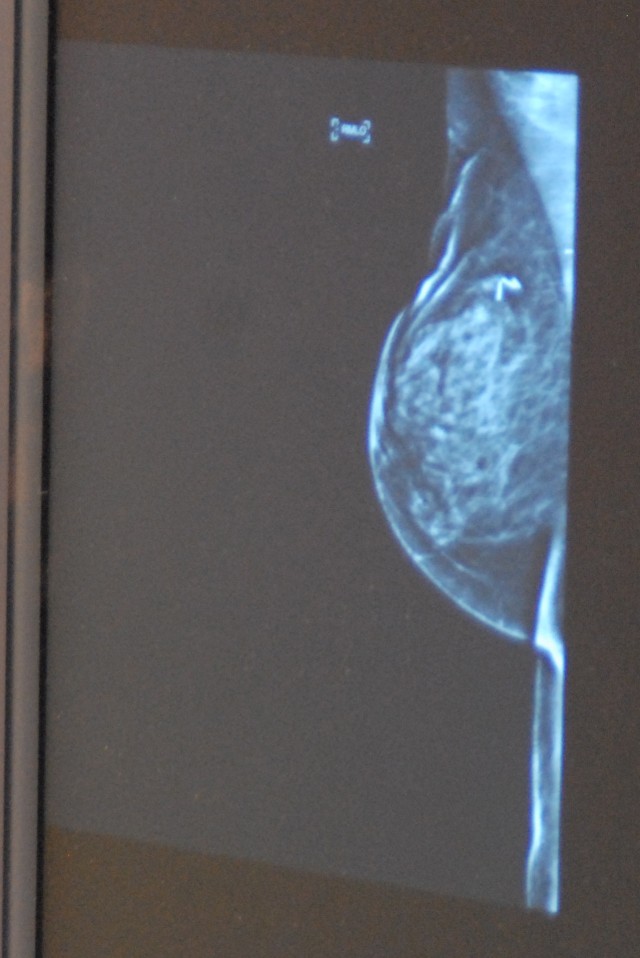 Digital equipment available at Ireland for mammograms