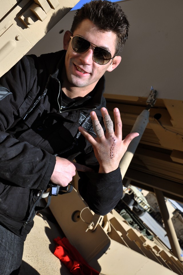 FORT HOOD, Texas-Dominick Cruz, Ultimate Fighting Championship first Bantamweight title holder shows his injured hand to Soldiers in the 1st Battalion, 21st Field Artillery Regiment, 41st Fires Brigade, during a visit at their motorpool, Jan. 21. Cru...