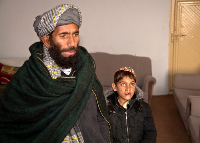 13-year-old Afghan boy receives facial surgery to correct birth defect