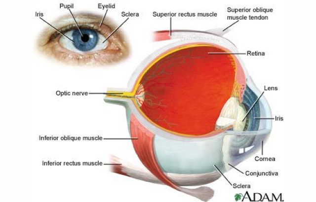 Glaucoma graphic