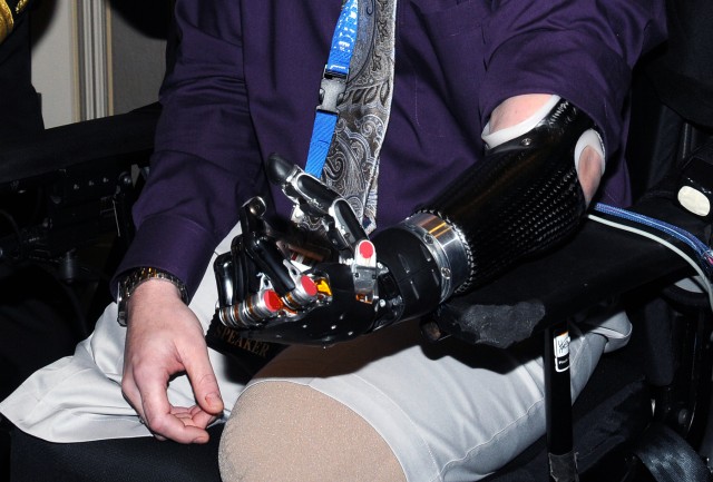 DOD working toward fully functional prosthetic arms