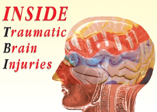 Traumatic Brain Injury graphic