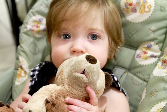 cleft palate