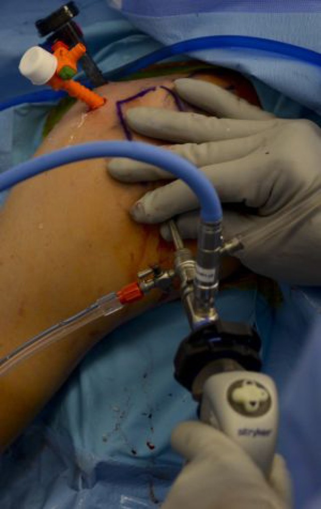 Supplying surgical services