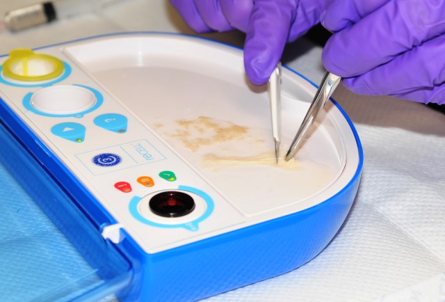 Harvesting skin cells
