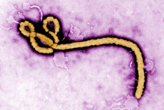 Ebola Viris