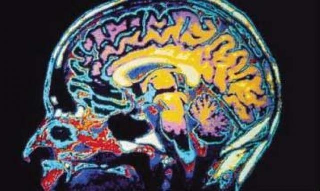 Brain trauma experts talk impact, emerging care options