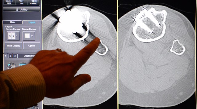 GLWACH's new CT scanning systen can take a 3D image of the entire heart in less than one heartbeat.