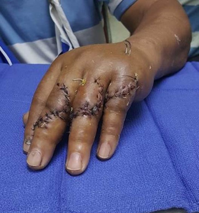 SAMMC Docs focus on healing hands and arms