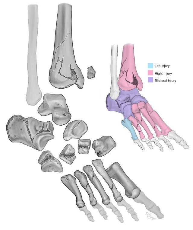 Army illustrator helps researchers