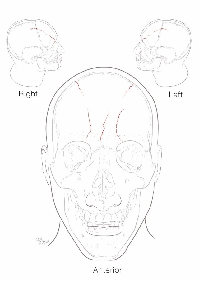 Army illustrator helps researchers