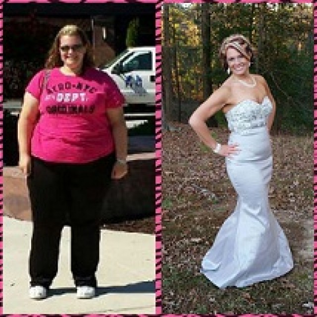 Kari Greisbach - Before and After