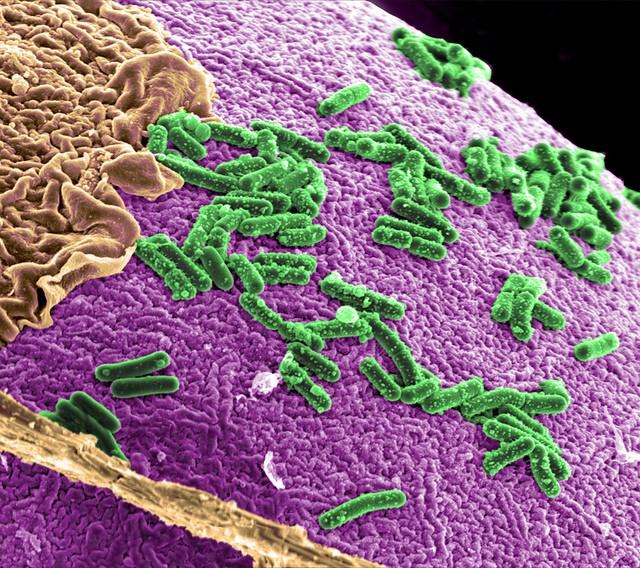 Army's Research Institute conducts MRE study to improve gut health