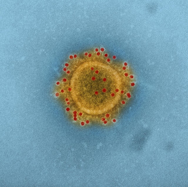 Army scientists begin first MERS vaccine clinical trial