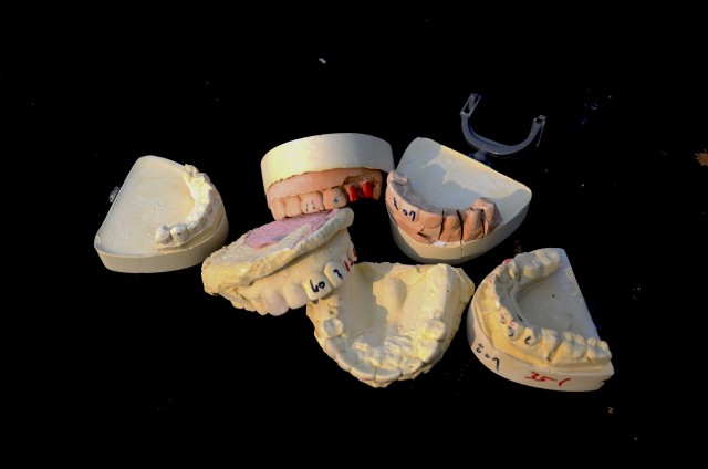 Dental molds