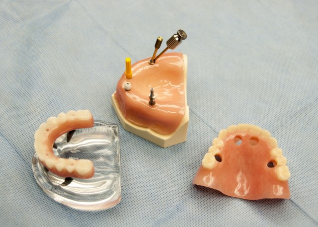 Dental procedure streamlines Soldier readiness