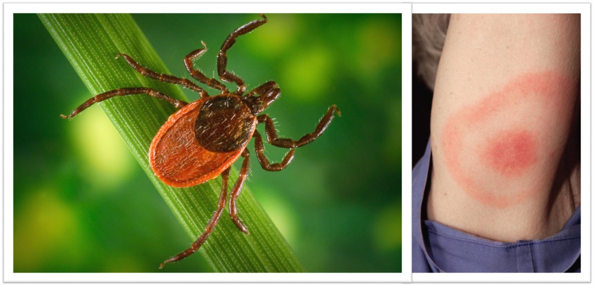Tick Season Keep Your Outdoors Family Safe Article The United