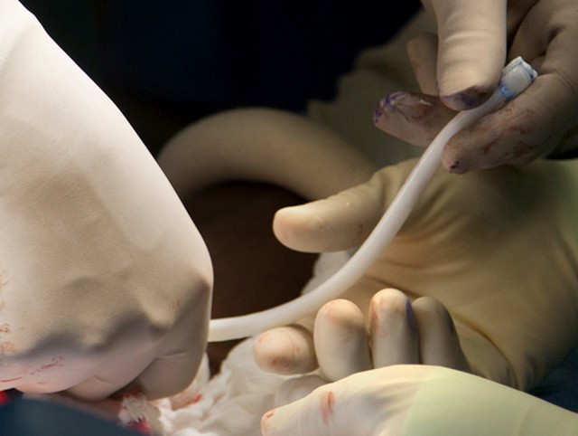 Seeking permanent repair of damaged blood vessels