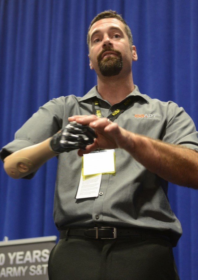Innovative prosthetic helps amputee compensate for loss of arm