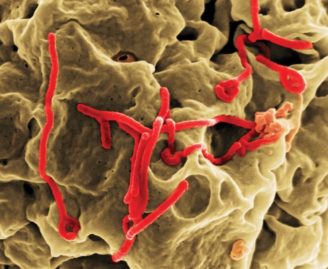 THE EBOLA VIRUS