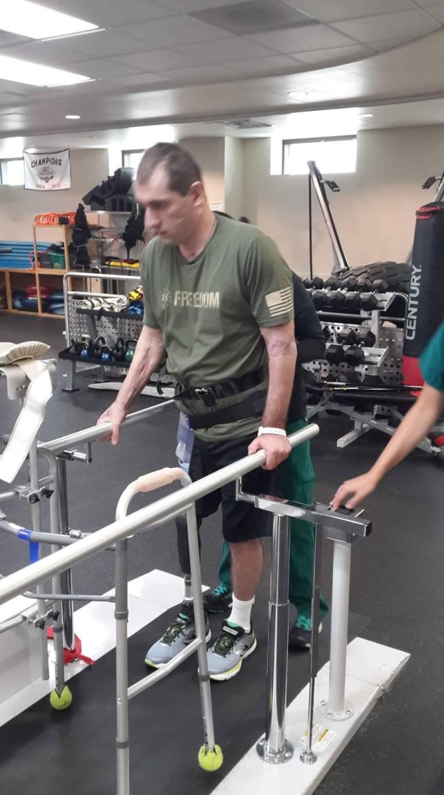 Iveri Buadze walks with prosthetic leg