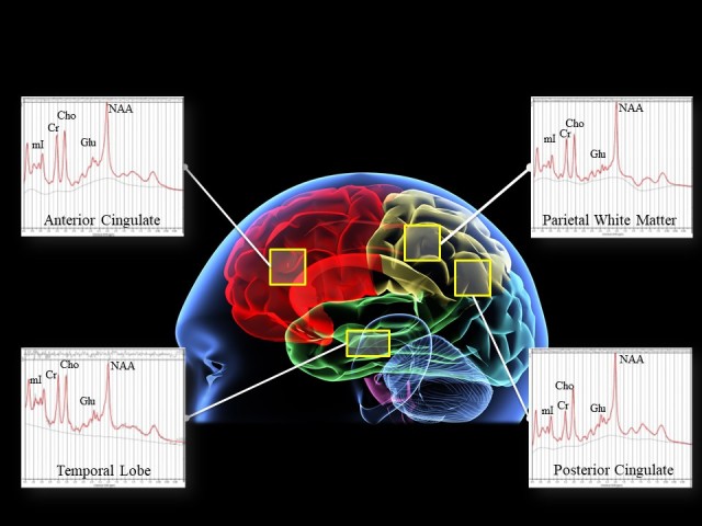 Brain scan of research into Soldier performance