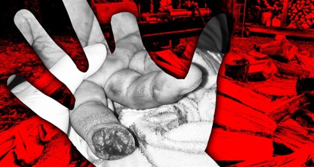 In the 20-plus years my parents had been heating their house with a wood-burning stove, we'd avoided any major accidents. In the eight years since I lost my fingers, the safety record has remained at