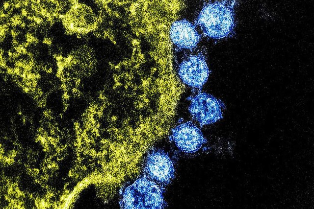 The Centers for Disease Control and Prevention has said that the coronavirus, named 2019-nCoV, is similar to the Middle East Respiratory Syndrome coronavirus in that it is spread from animals to people. The MERS virus particles are in blue, surrounding an infected cell. The undated image was taken at Fort Detrick, Maryland. 