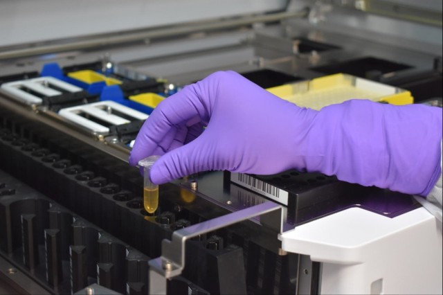 A patient sample is loaded into a nucleic acid extractor