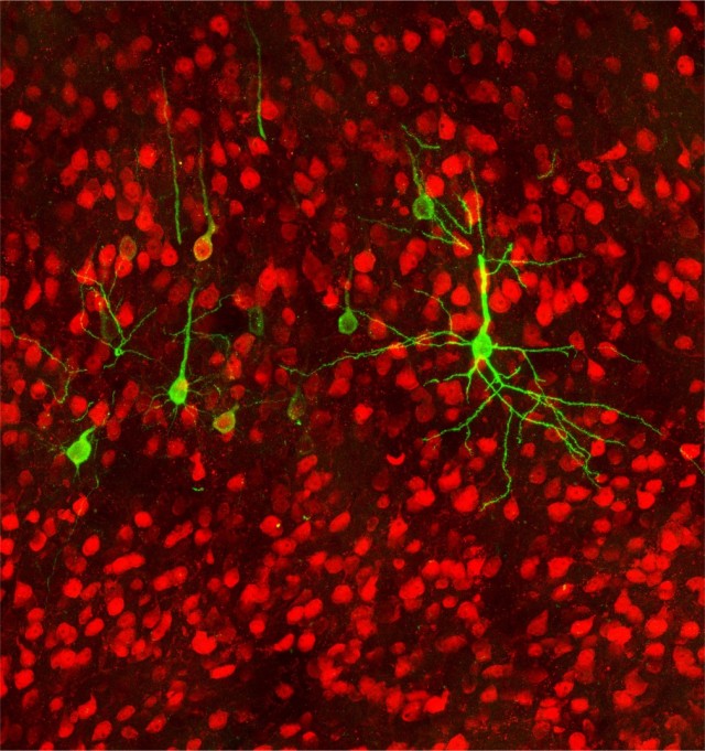 Research, conducted at the University of Pittsburgh Brain Institute and funded by the Army Research Office traced neural pathways that connect the brain to the stomach, providing a biological mechanism that explains the connection.
