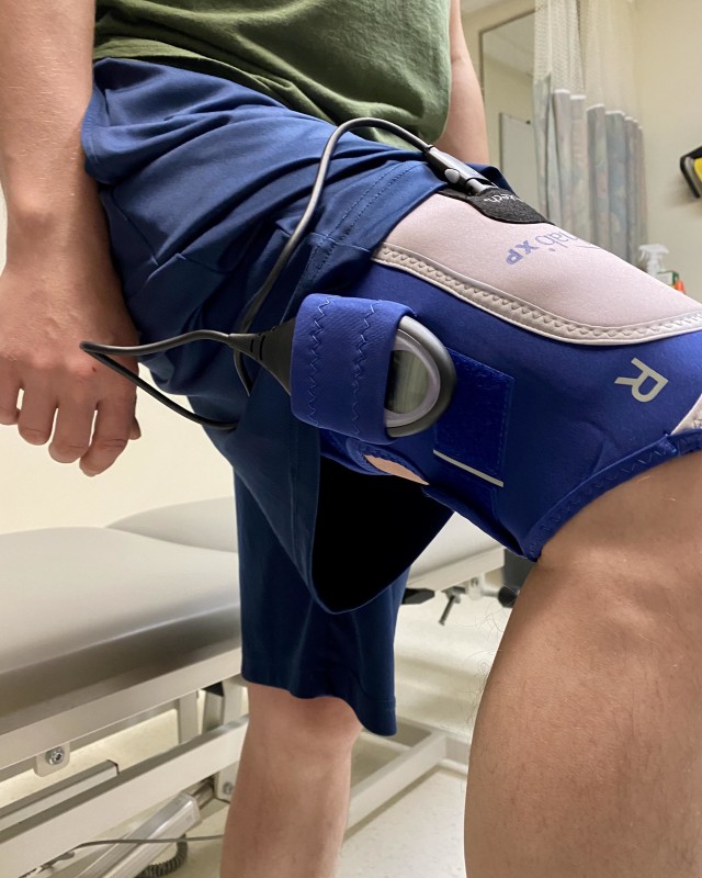 BACH physical therapist Dr. Lee Webb, models a neuromuscular electrical stimulation device used by Soldiers who participated in a research project aimed at finding effective methods to treat service members with patellofemoral pain syndrome, or runner’s knee. The device uses electricity to stimulate muscles and nerves to help improve flexibility, strength and movement.