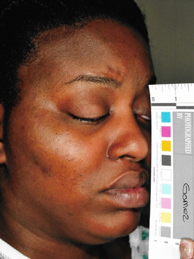 Victoria Tyler, a survivor of domestic abuse and a Fort Bragg Family member, shares a photo taken at the hospital following an attack from her abuser in 2016. (Courtesy Photo)