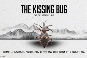 Not all Kisses are Sweet; Expert Advice on Chagas Disease
