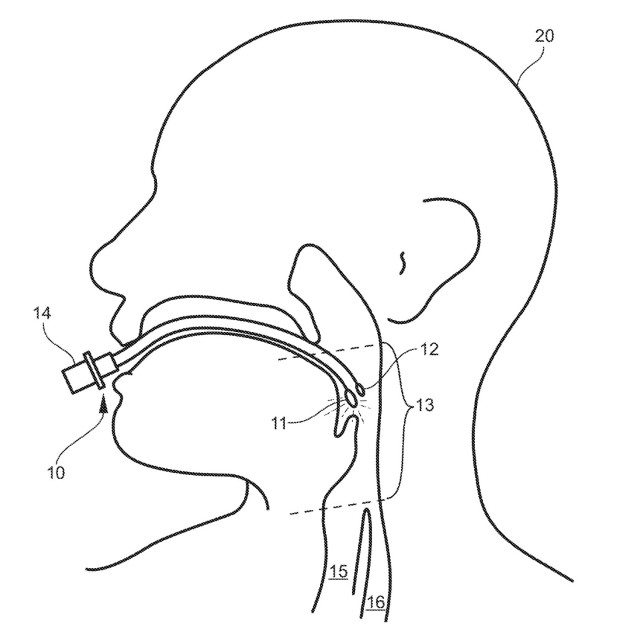 MRDC Seeks Entrepreneurs to License Innovative Airway Surgical Devices (Part 1)