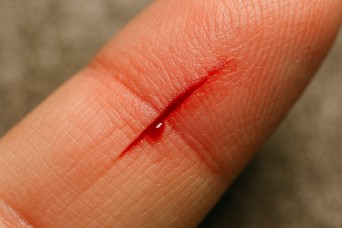 The Value of 1,000 Papercuts: A Paradigm Shift in the Strategic Environment