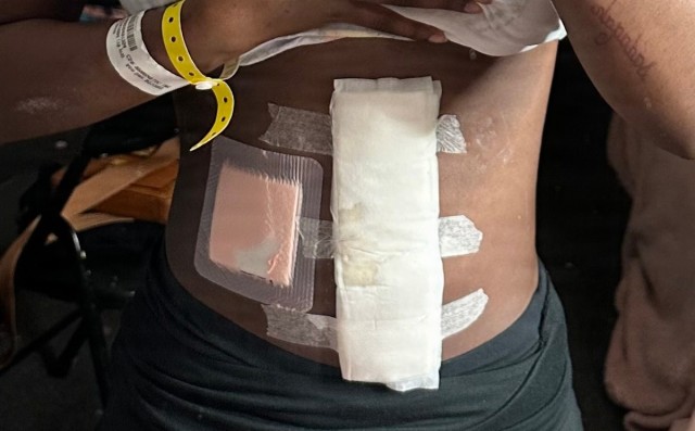 U.S. Army National Guard Soldier Saves her own life using lessons learned in Basic Combat Training